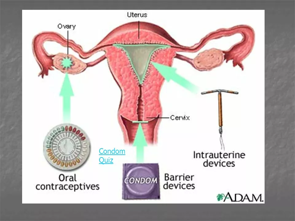 The Relationship between Contraception and Body Weight